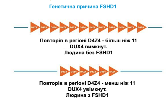 FSHD1 genetic reason DUX4 repeats in region D4Z4